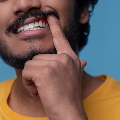 adult-man-showing-his-periodontal-disease-before-camera